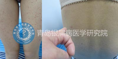 ������м�缲��������������