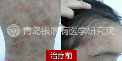 ��ҩѬ������ 8����м��Ůͯ�����һ��΢Ц