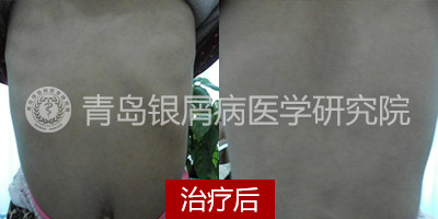 ��ҩѬ������ 8����м��Ůͯ�����һ��΢Ц